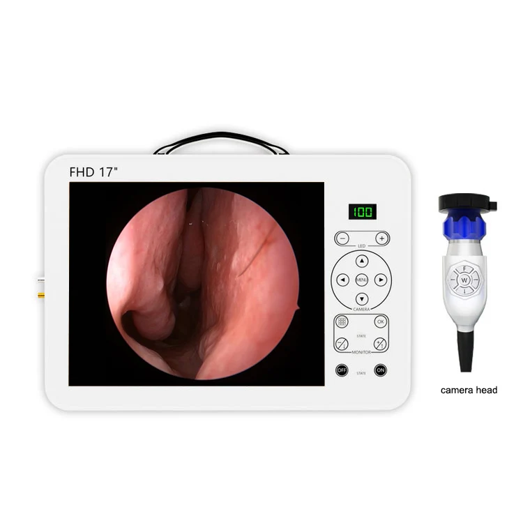 Set Sistem Diagnostik THT Otos - Medical Lab Images ulasan dan harga