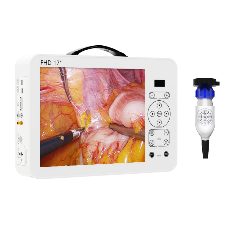 Set Sistem Diagnostik THT Otos - Medical Lab Images ulasan dan harga